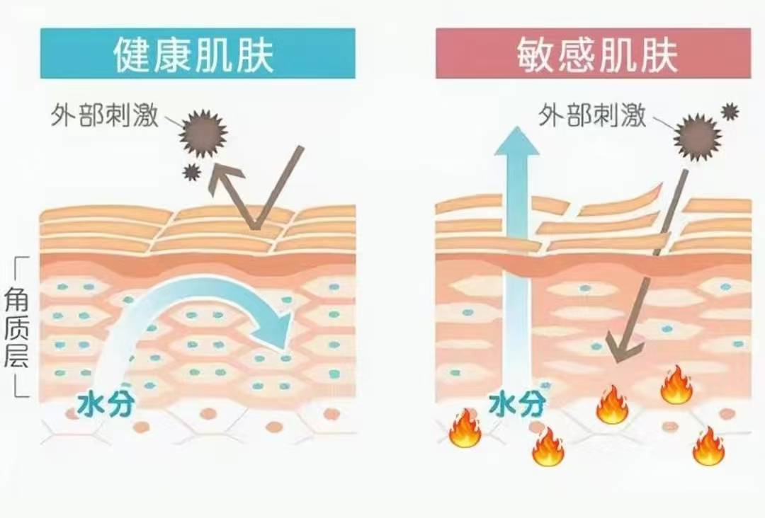 踩雷无数次总结，敏感肌值得托付的防晒，这6款热门防晒会更适合